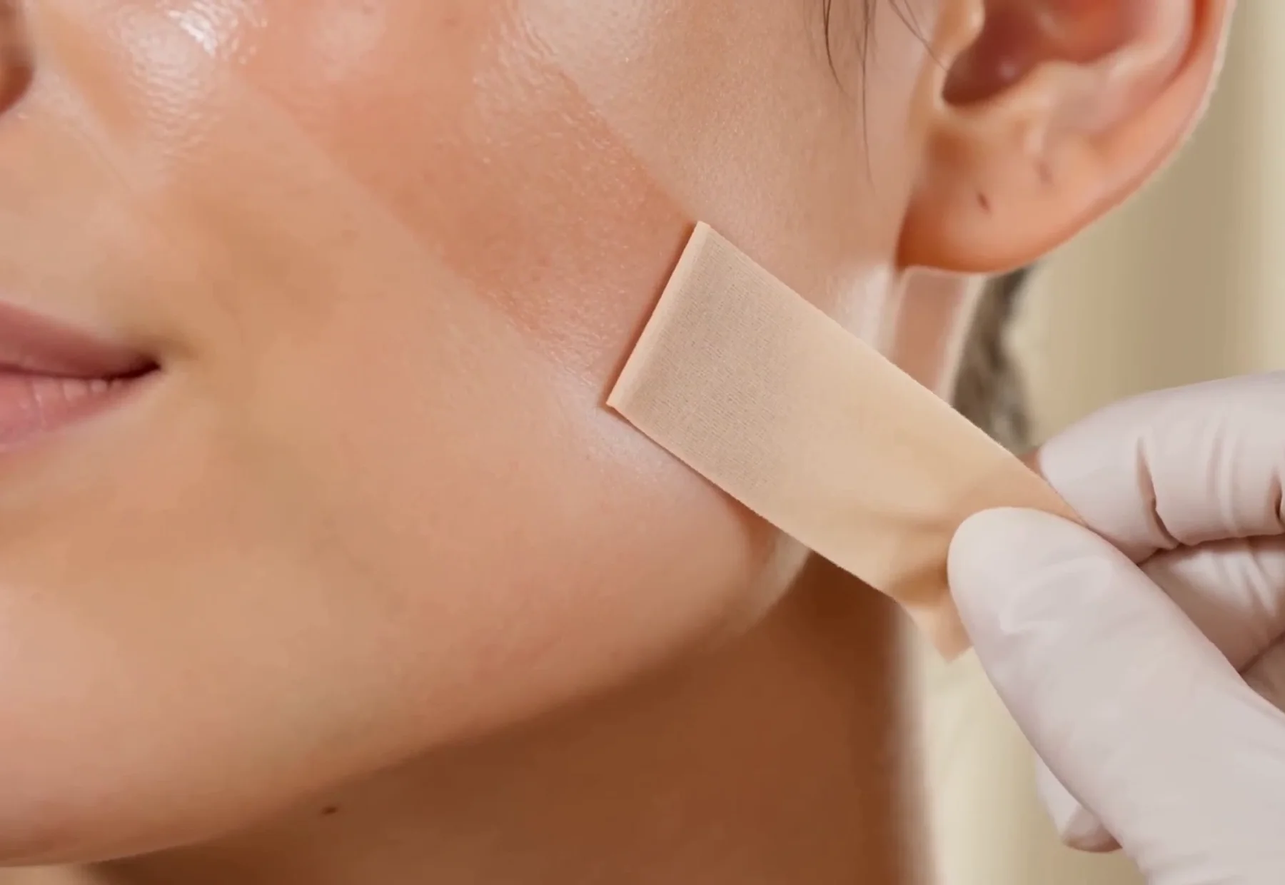 Bio-esthetische kinesiotaping